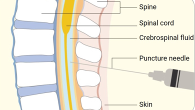 How Does Intrathecal Injection Enhance CNS Drug Delivery?