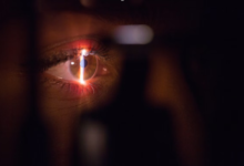 Does Laser Eye Surgery Hurt?